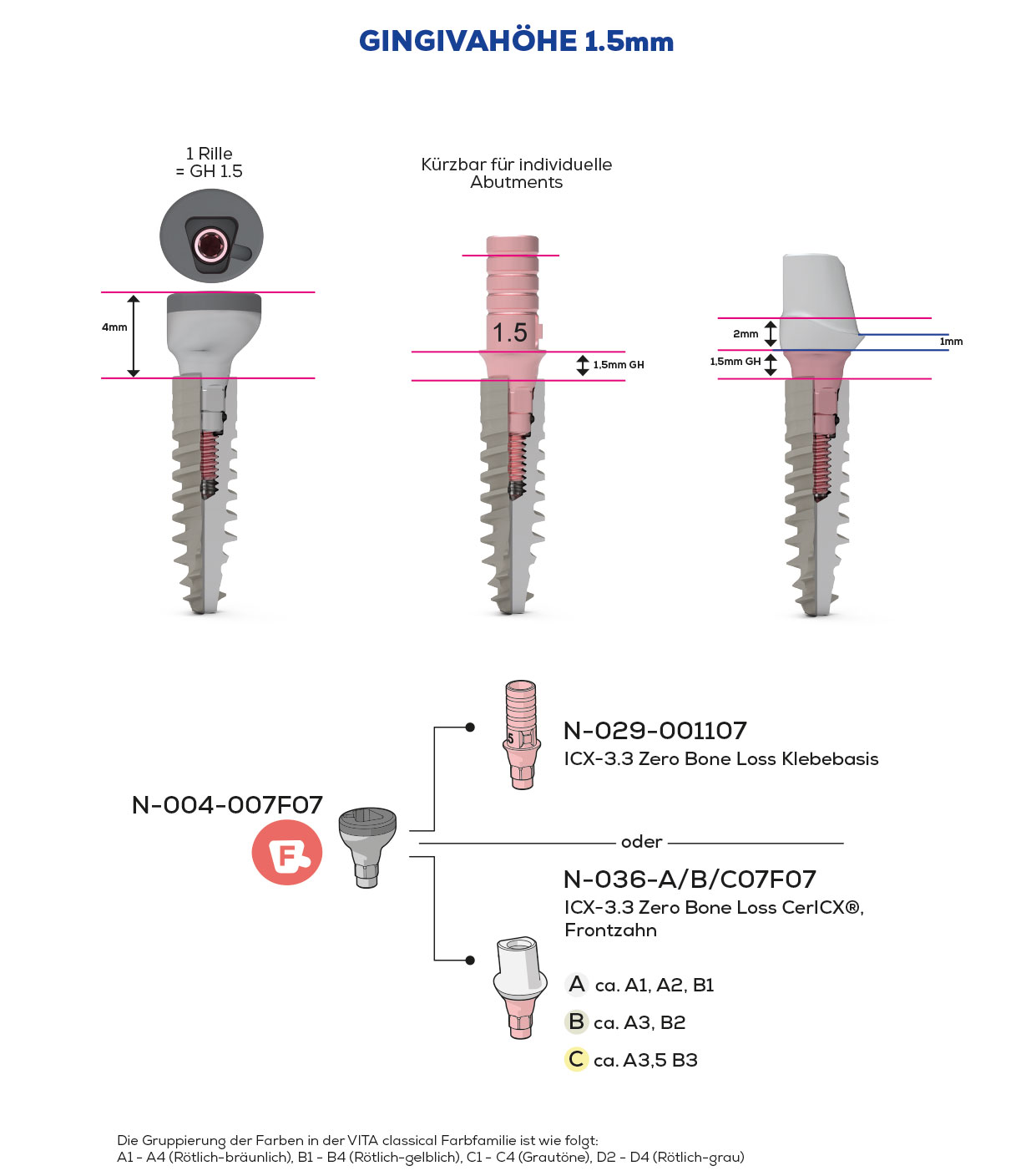ICX-3.3 Zero Bone Loss, Scan & Heal, Frontzahn