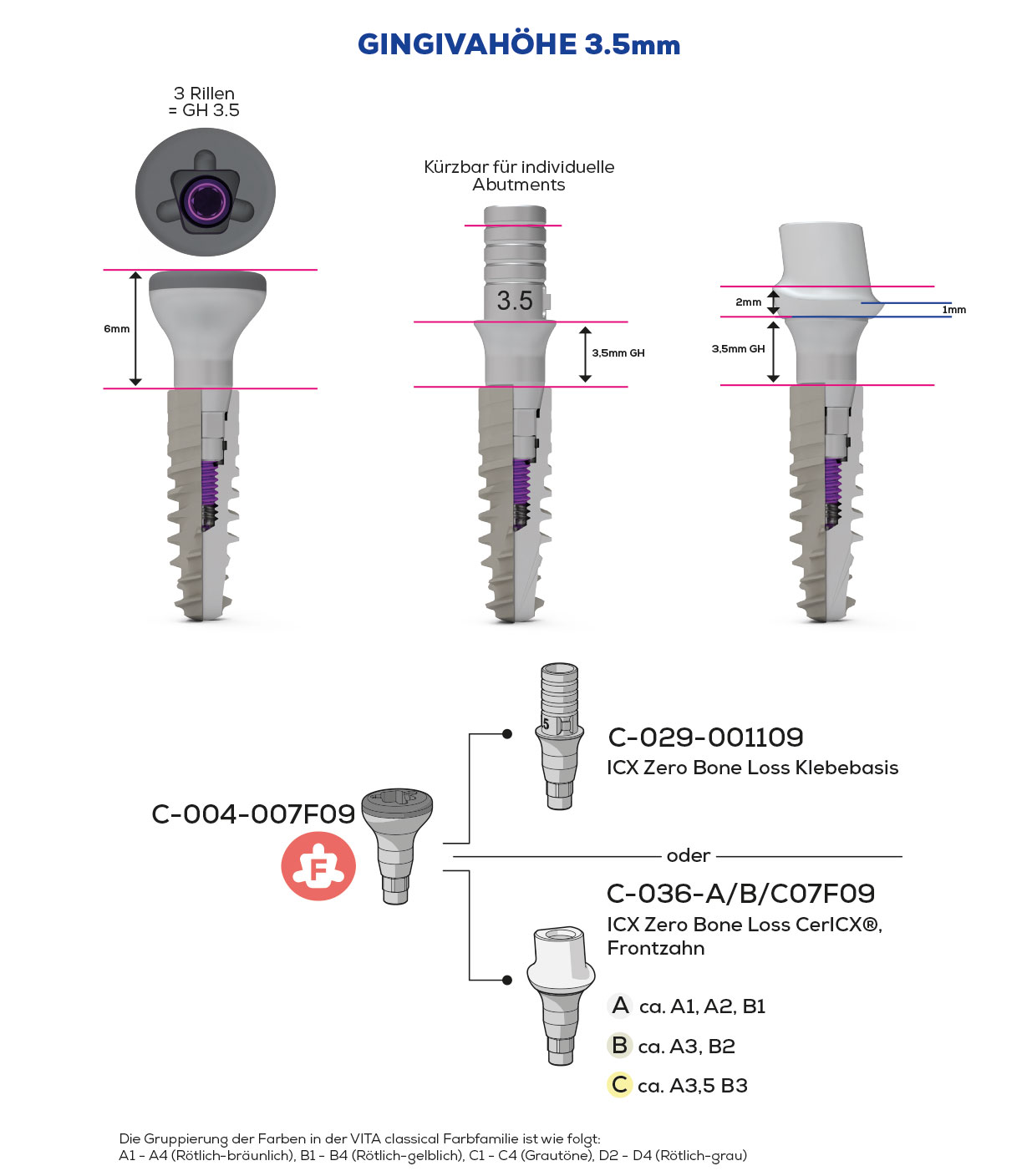 ICX-Zero Bone Loss, Scan & Heal, Frontzahn