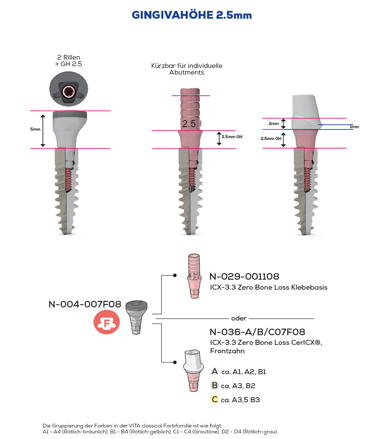 ICX-3.3 Zero Bone Loss, Scan & Heal, Frontzahn