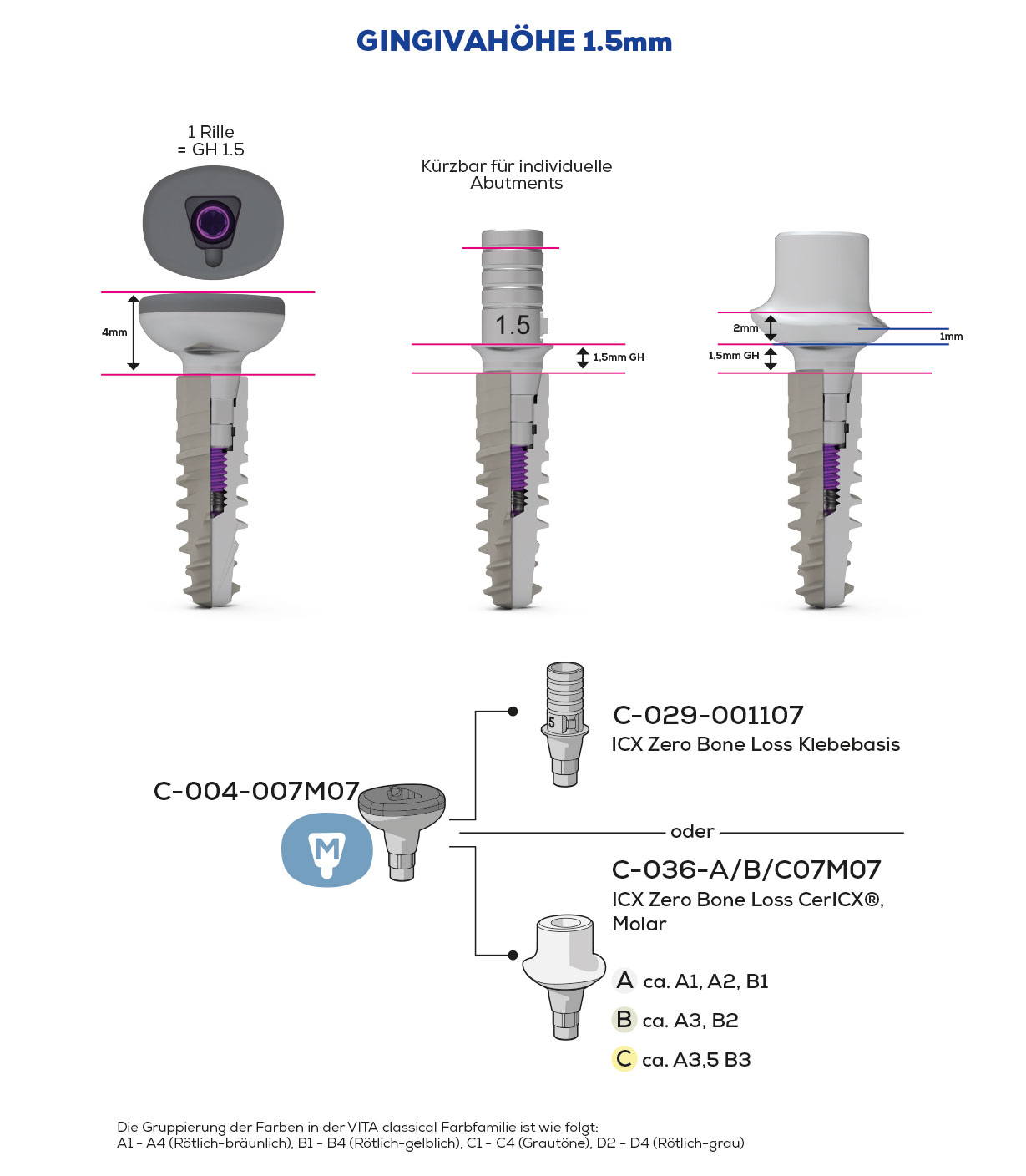 ICX Zero Bone Loss, Scan & Heal, Molar