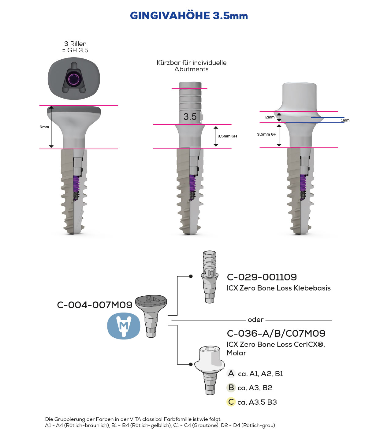 ICX Zero Bone Loss, Scan & Heal, Molar
