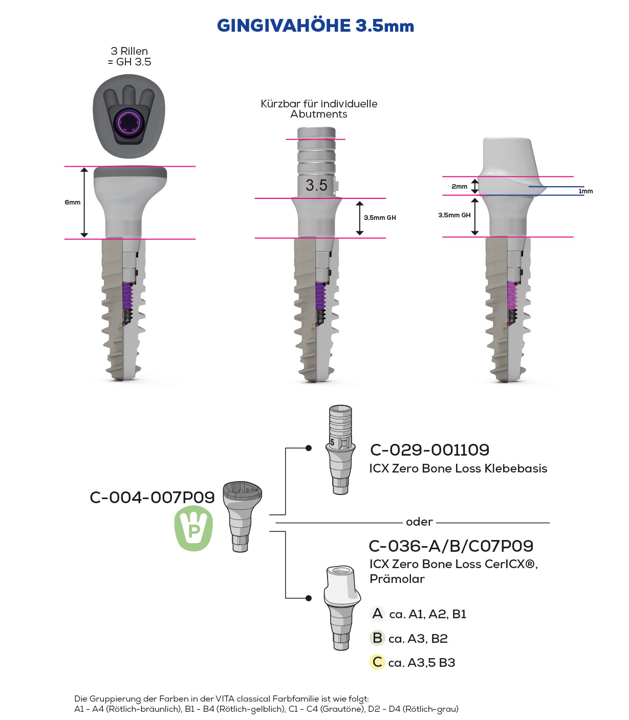 ICX-Zero Bone Loss, Scan & Heal, Prämolar