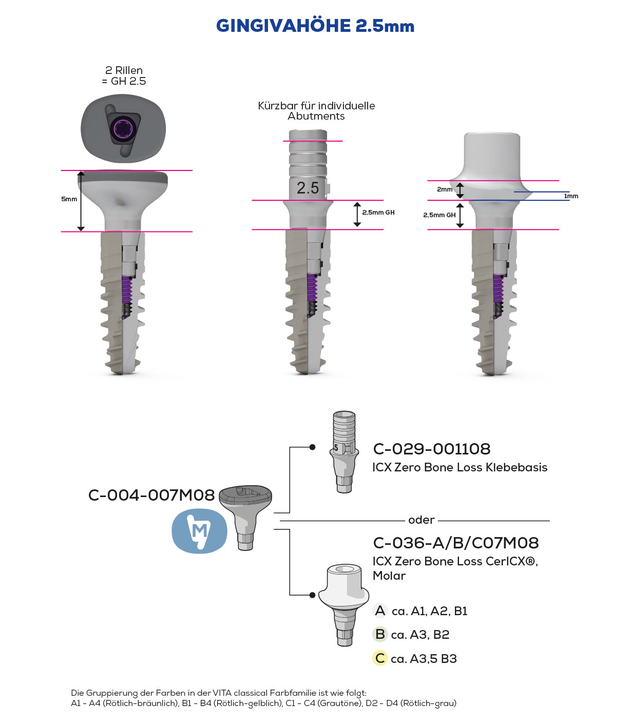 ICX Zero Bone Loss, Scan & Heal, Molar