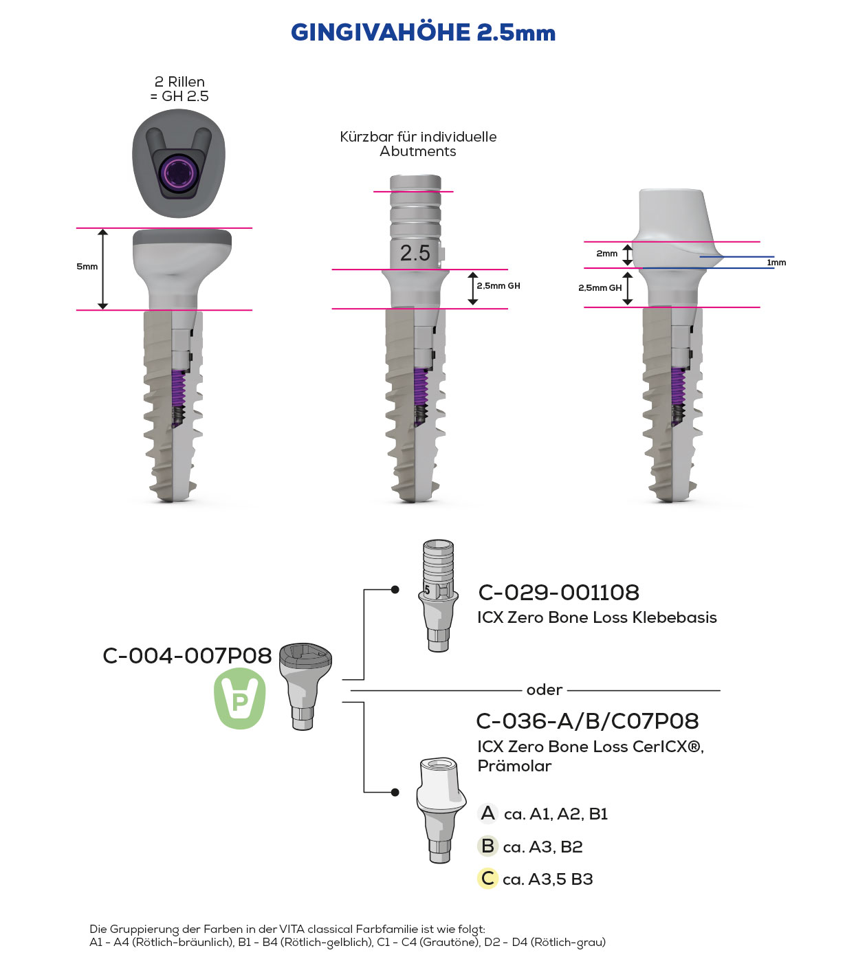ICX-Zero Bone Loss, Scan & Heal, Prämolar