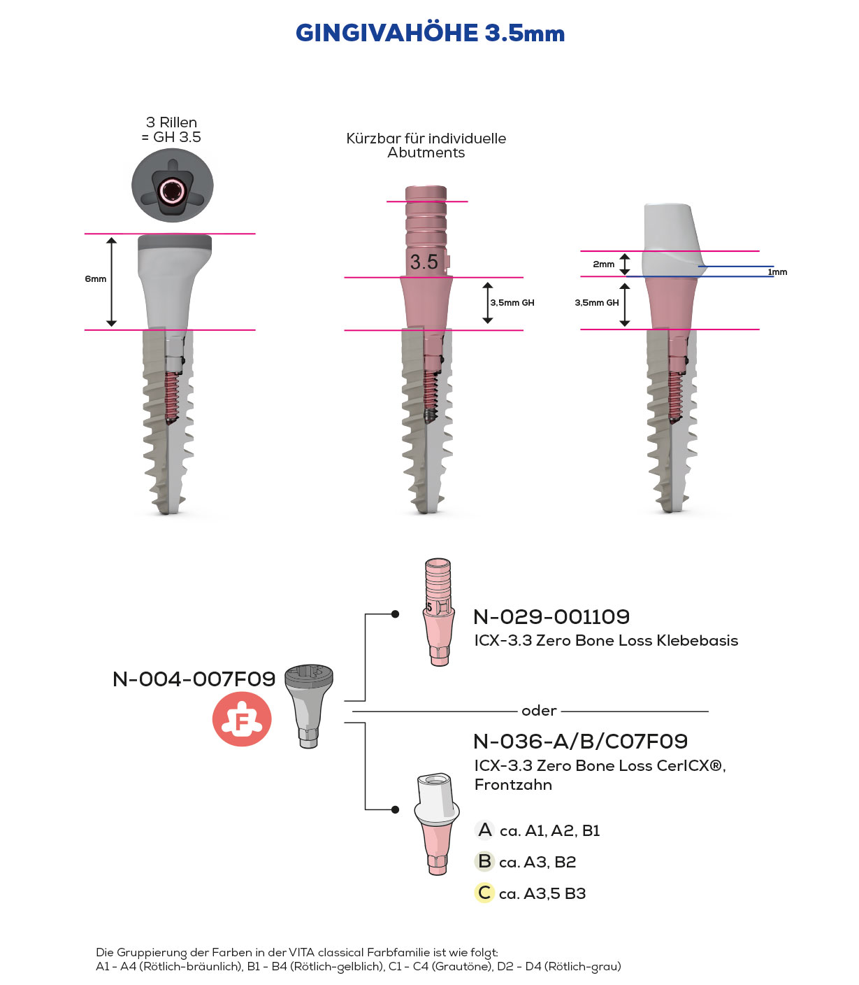 ICX-3.3 Zero Bone Loss, Scan & Heal, Frontzahn